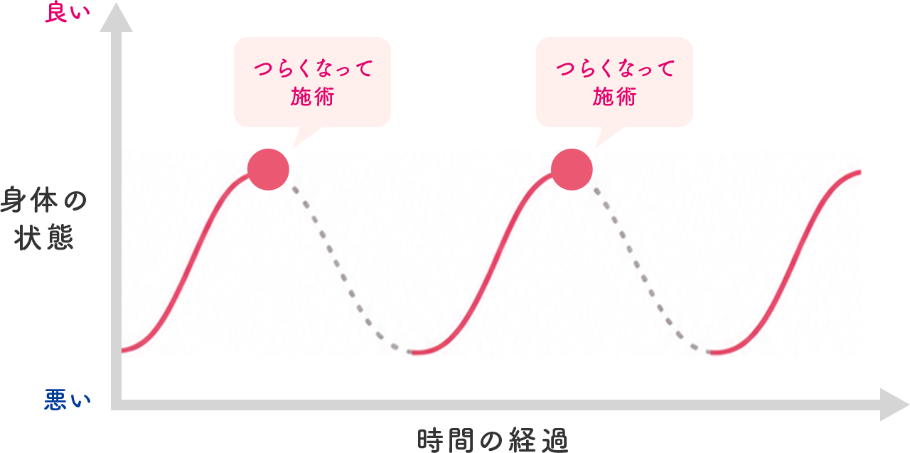グラフ